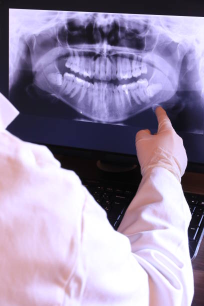 Best Orthodontic Emergency Dentist in Saxon, SC